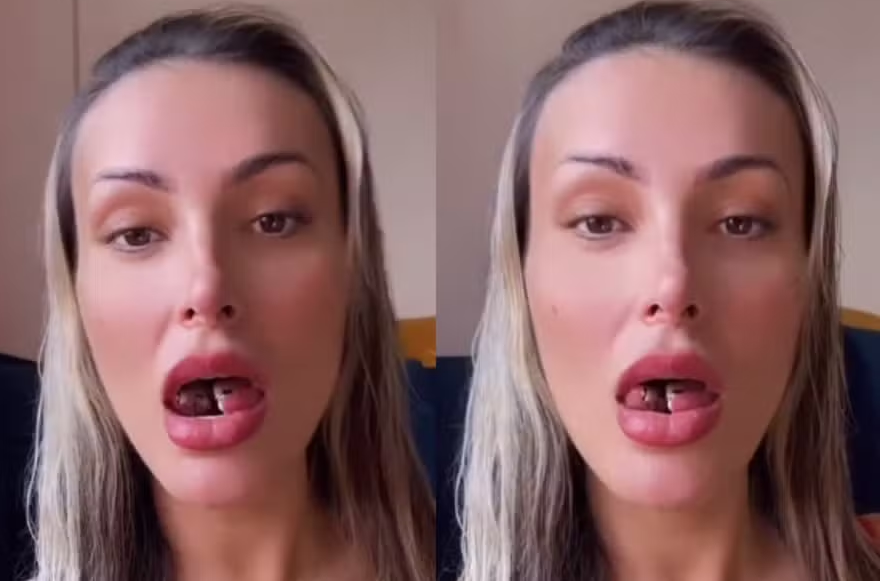 L Ngua De Cobra Entenda O Procedimento Feito Por Andressa Urach