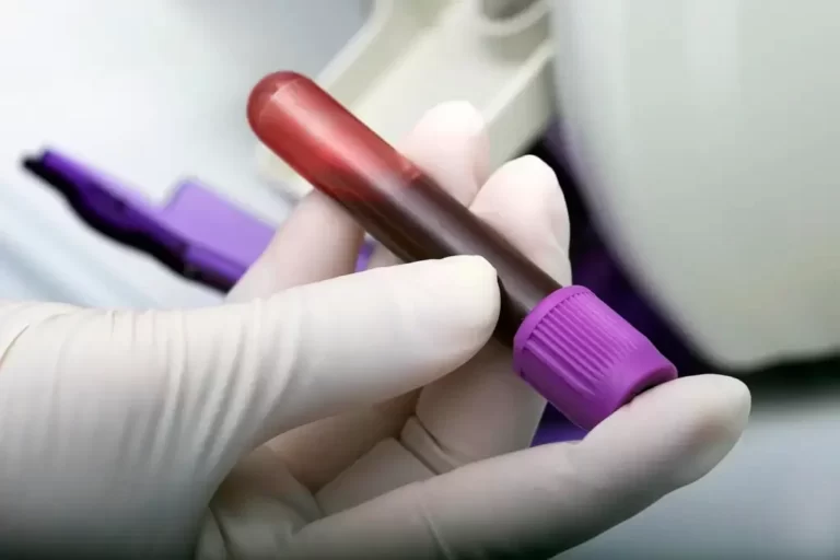 Exame de sangue para identificar sinais de Alzheimer chega ao Brasil