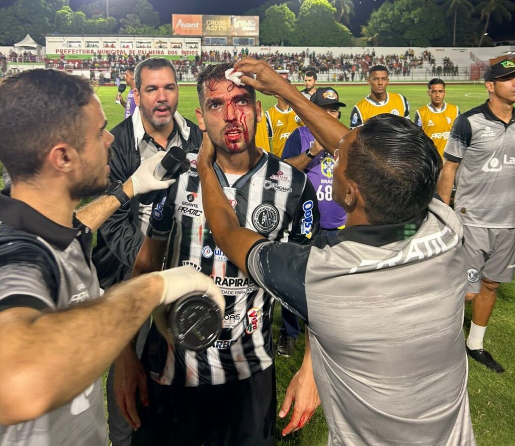 Justiça proíbe torcedor que agrediu atleta do ASA de frequentar Juca Sampaio e sair da cidade sem aviso prévio