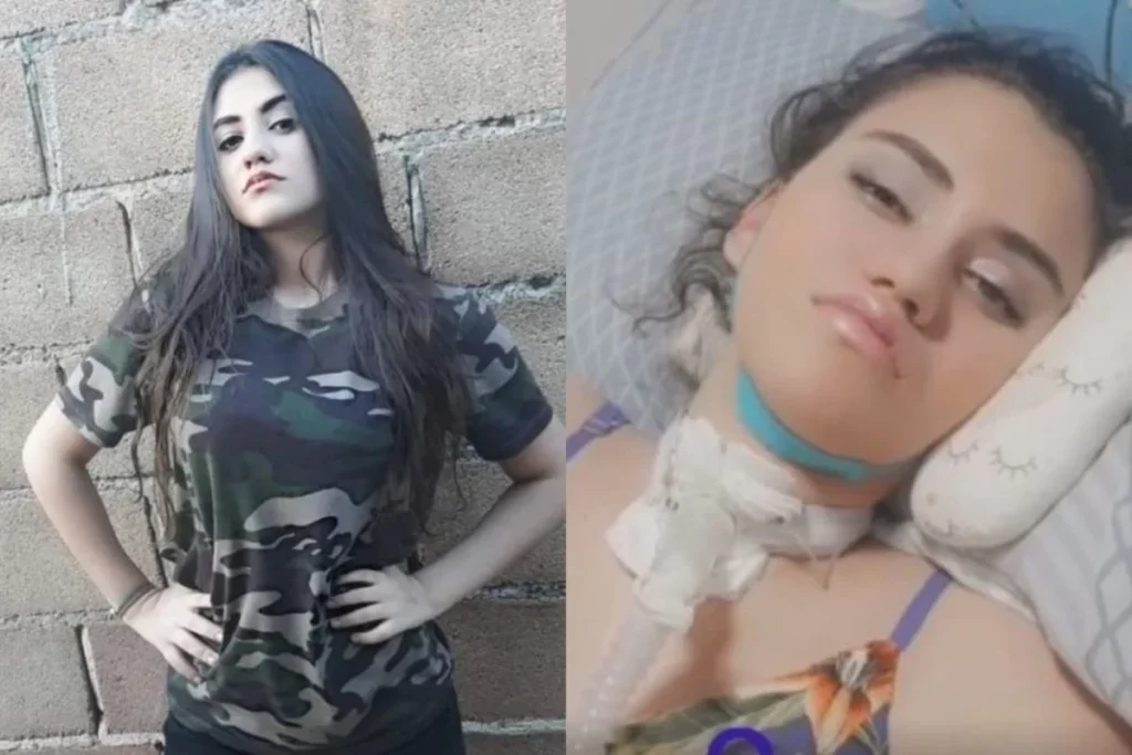 Vítima de dengue neurológica, jovem fica paraplégica, respira por aparelhos, mas faz faculdade