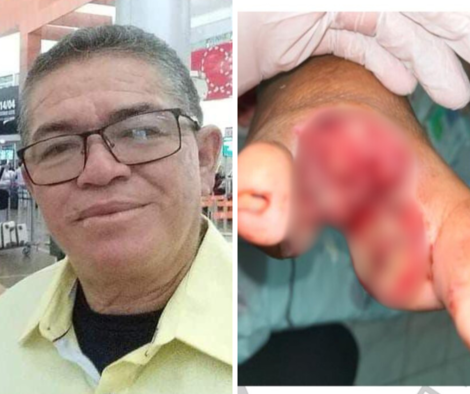 [Vídeo] Sorteio de rifa para ajudar no tratamento de sargento do 10° BPM acontece na próxima quarta (10)