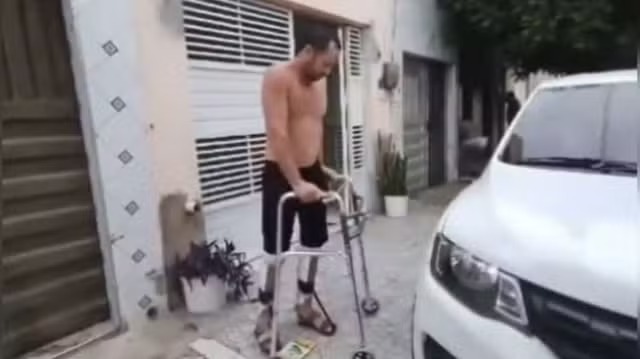 [Vídeo] Cearense atingido por aparelho de academia volta a ficar de pé e ter sensibilidade nas pernas