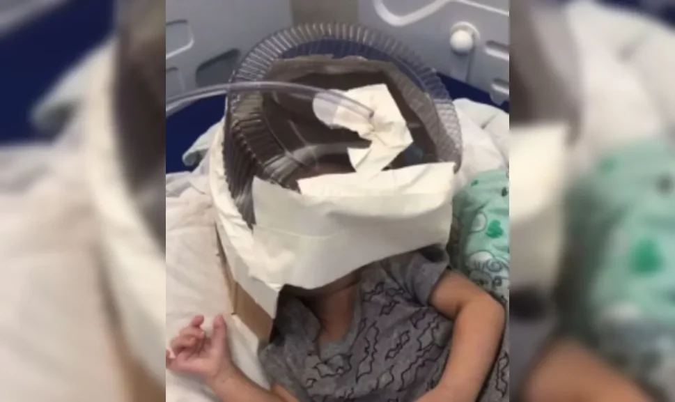 Hospital usa embalagem de bolo como máscara de oxigênio improvisada para bebê, no RN
