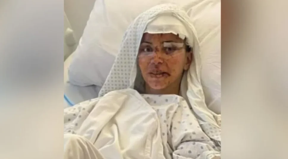 Brasileira ferida em bombardeio no Líbano tem primeira foto no hospital divulgada