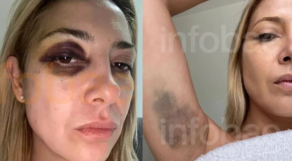 Ex-primeira dama Fabiola Yañez denunciou o ex-presidente da Argentina Alberto Fernández por violência doméstica