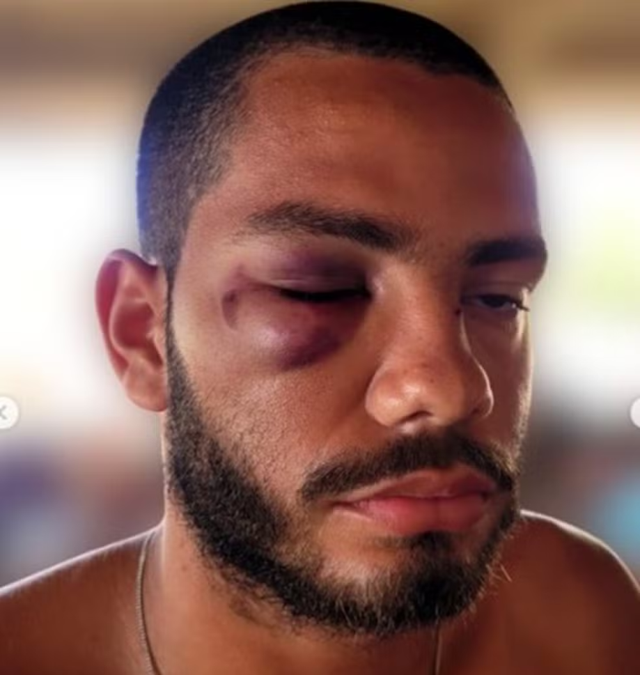 Lamentável: torcedores invadem campo e jogo da Copa Alagoas Sub-20 termina em pancadaria