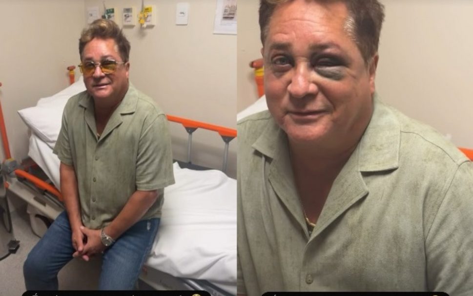 Leonardo sofre acidente em pescaria e surge com hematoma