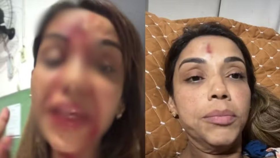 [Vídeo] Cantora Walkiria Estarley denuncia relacionamento abusivo e relata agressão do ex-companheiro