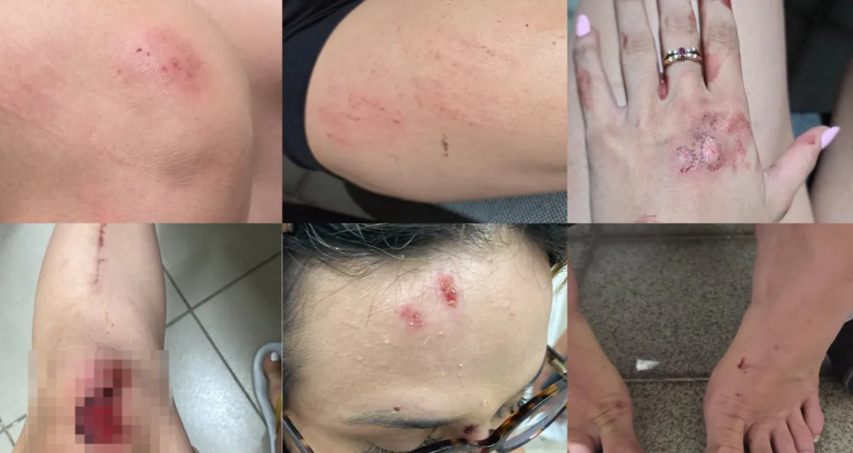 Influenciadora de Maceió relata agressão do ex e diz ter sido arrastada em carro por 100 metros